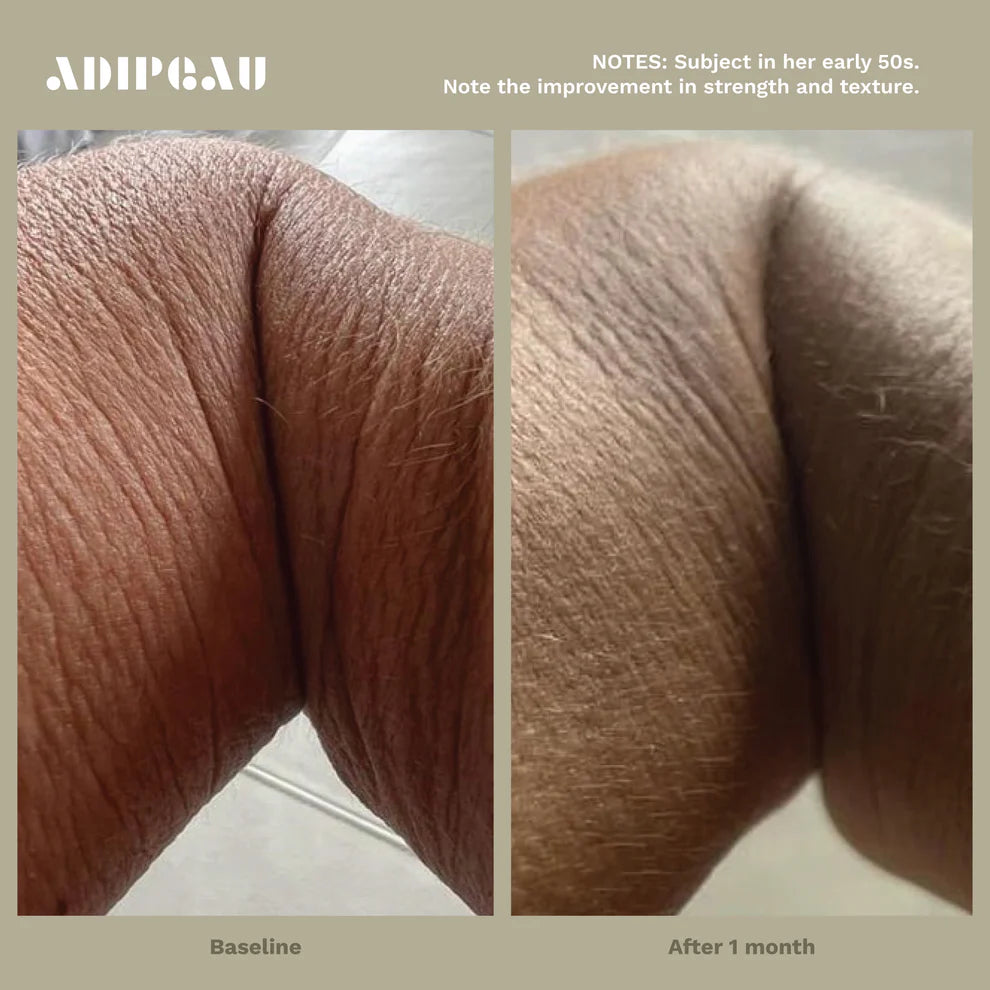 Intro to Adipeau Bundle