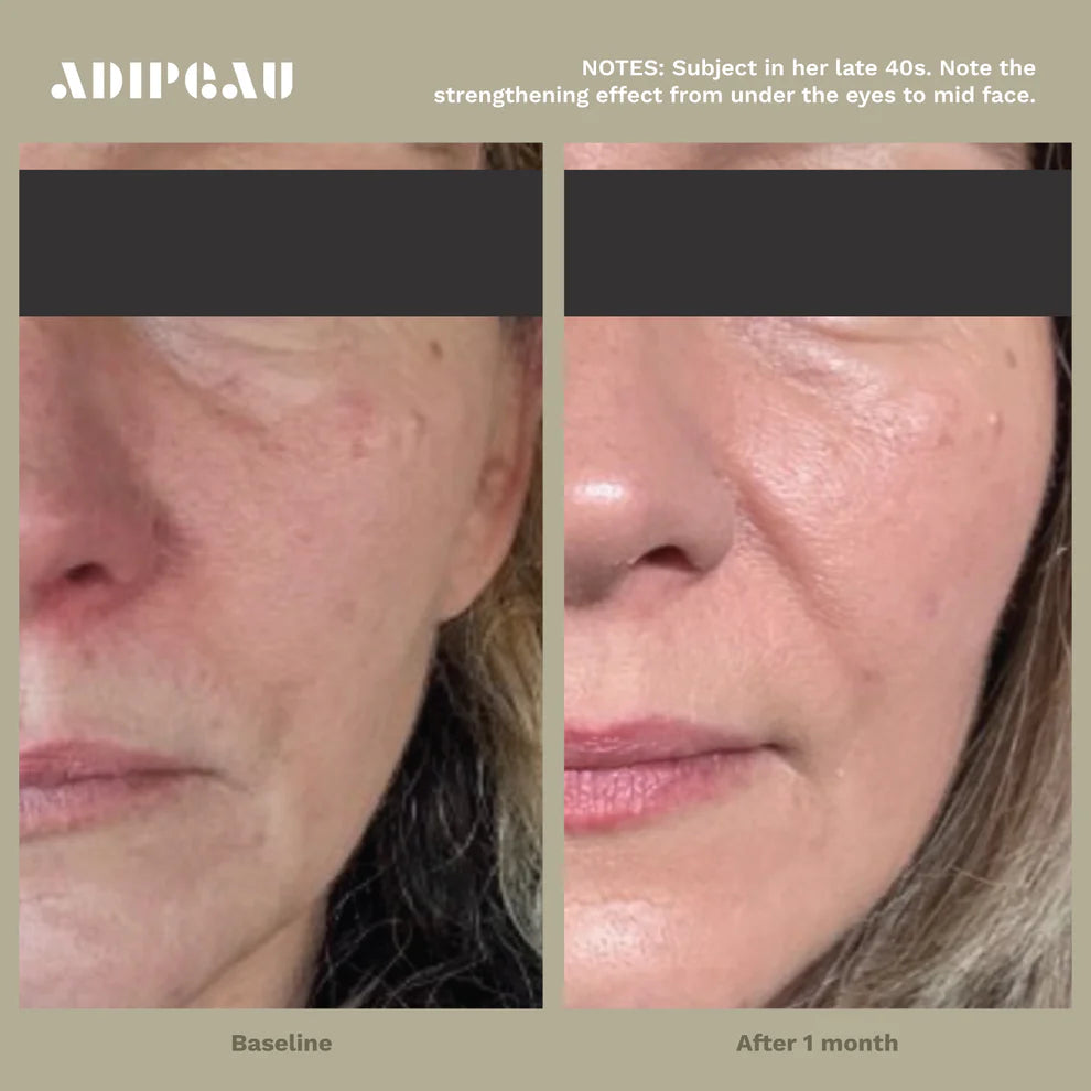 Intro to Adipeau Bundle