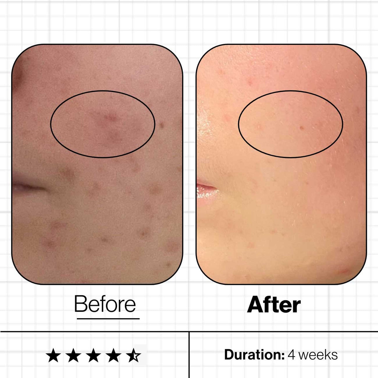 Advanced Nutrition Programme Skin Clear Biome™