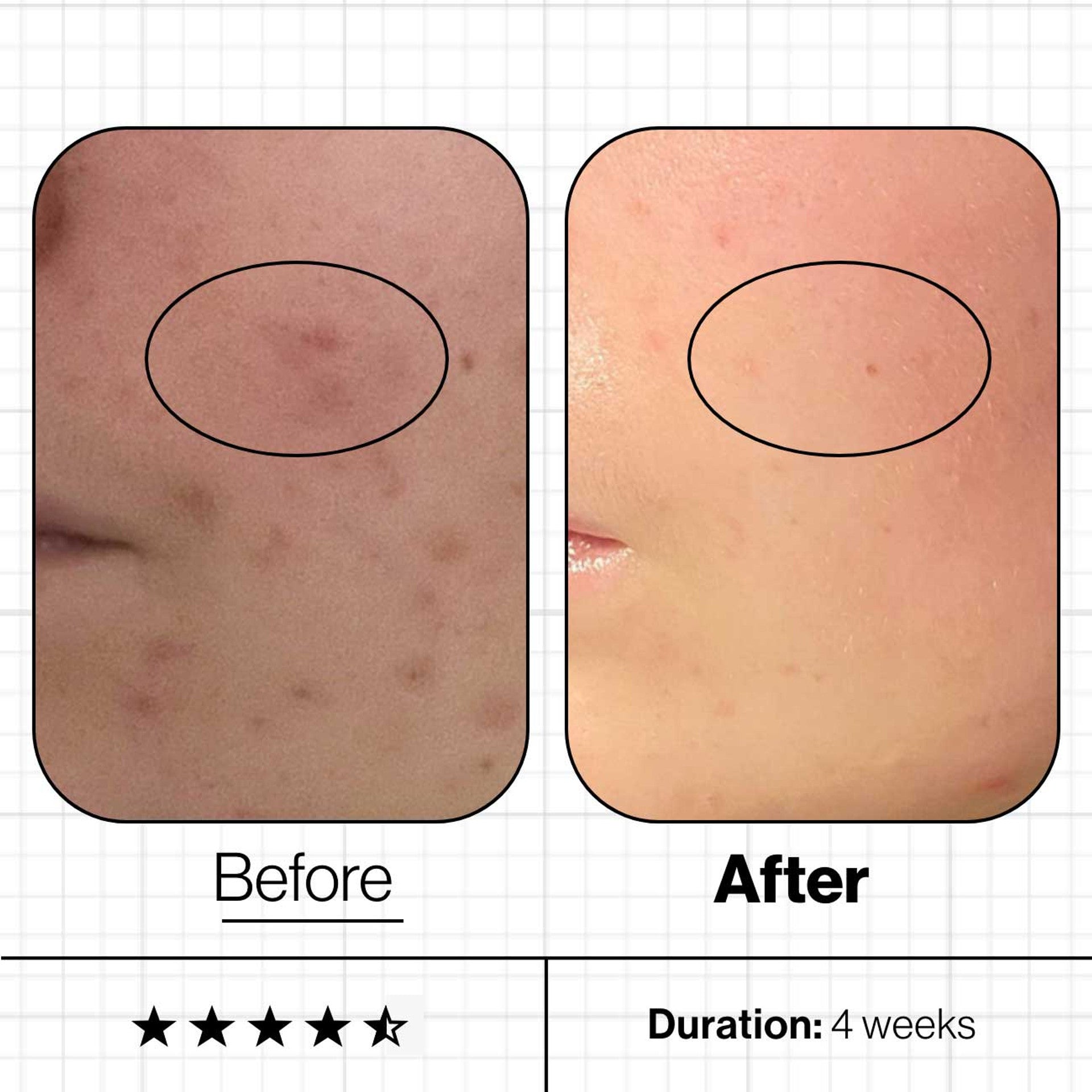 Advanced Nutrition Programme Skin Clear Biome™