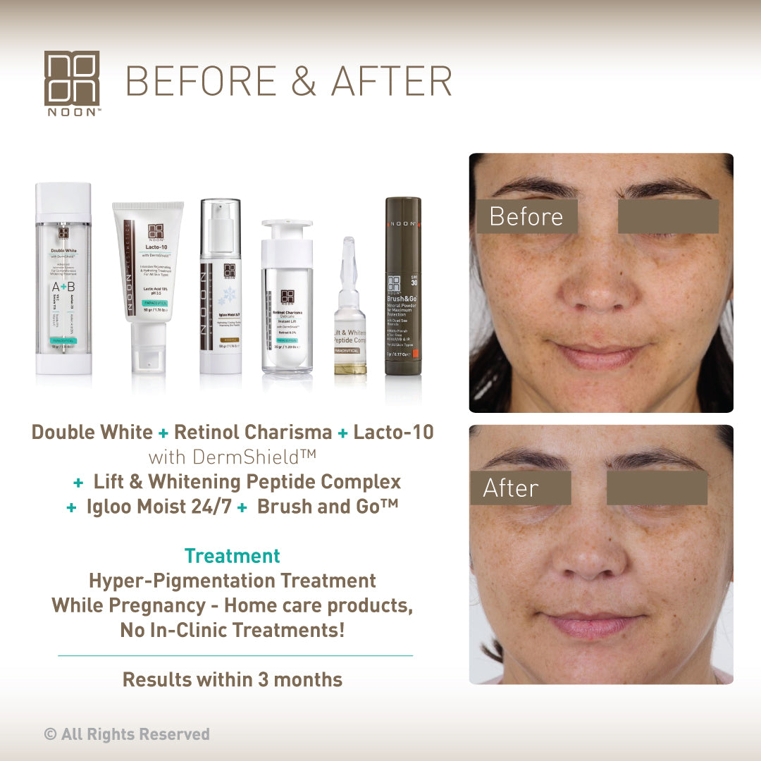 NOON Brightening Starter Skin