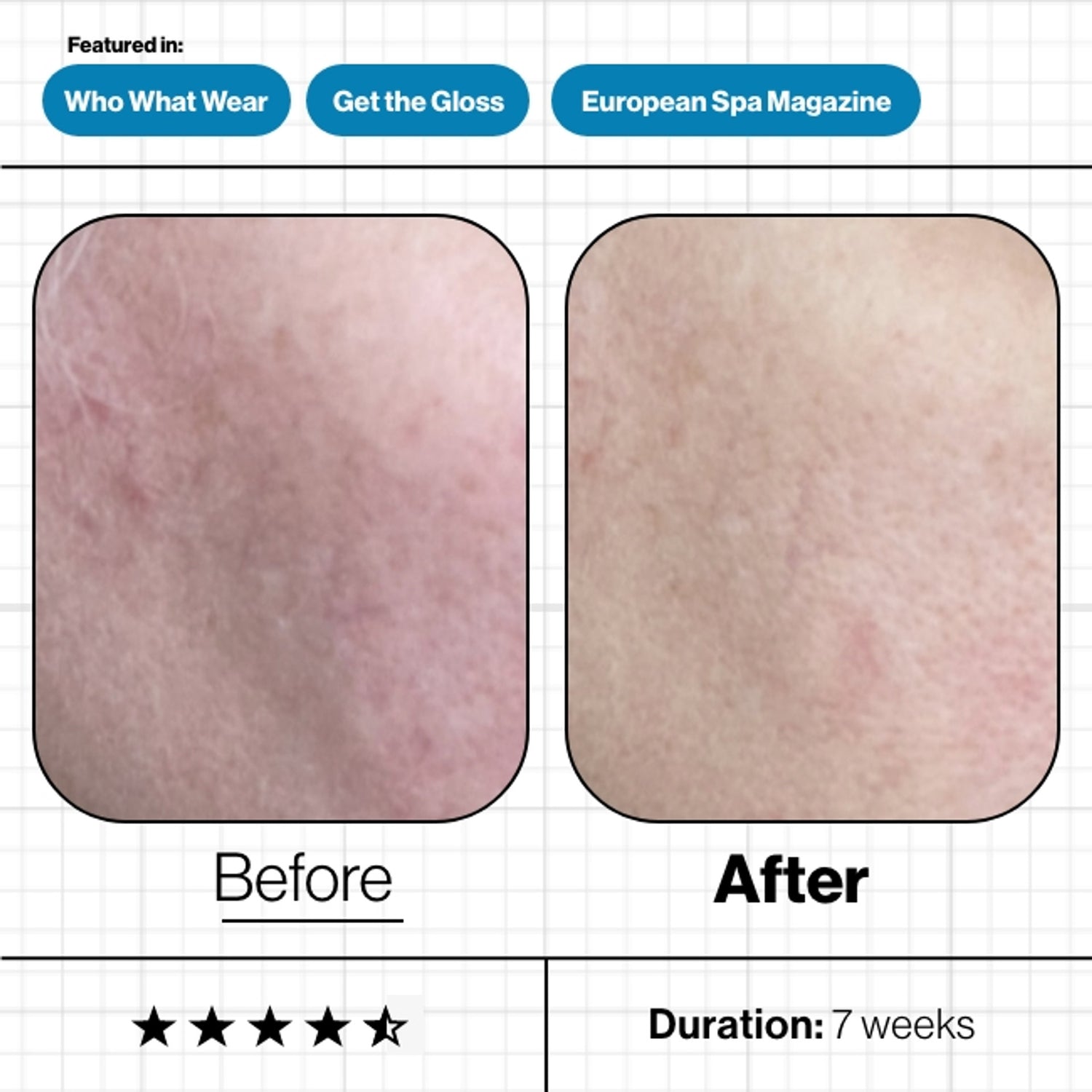 Advanced Nutrition Programme Skin Moisture IQ (NEW & IMPROVED)