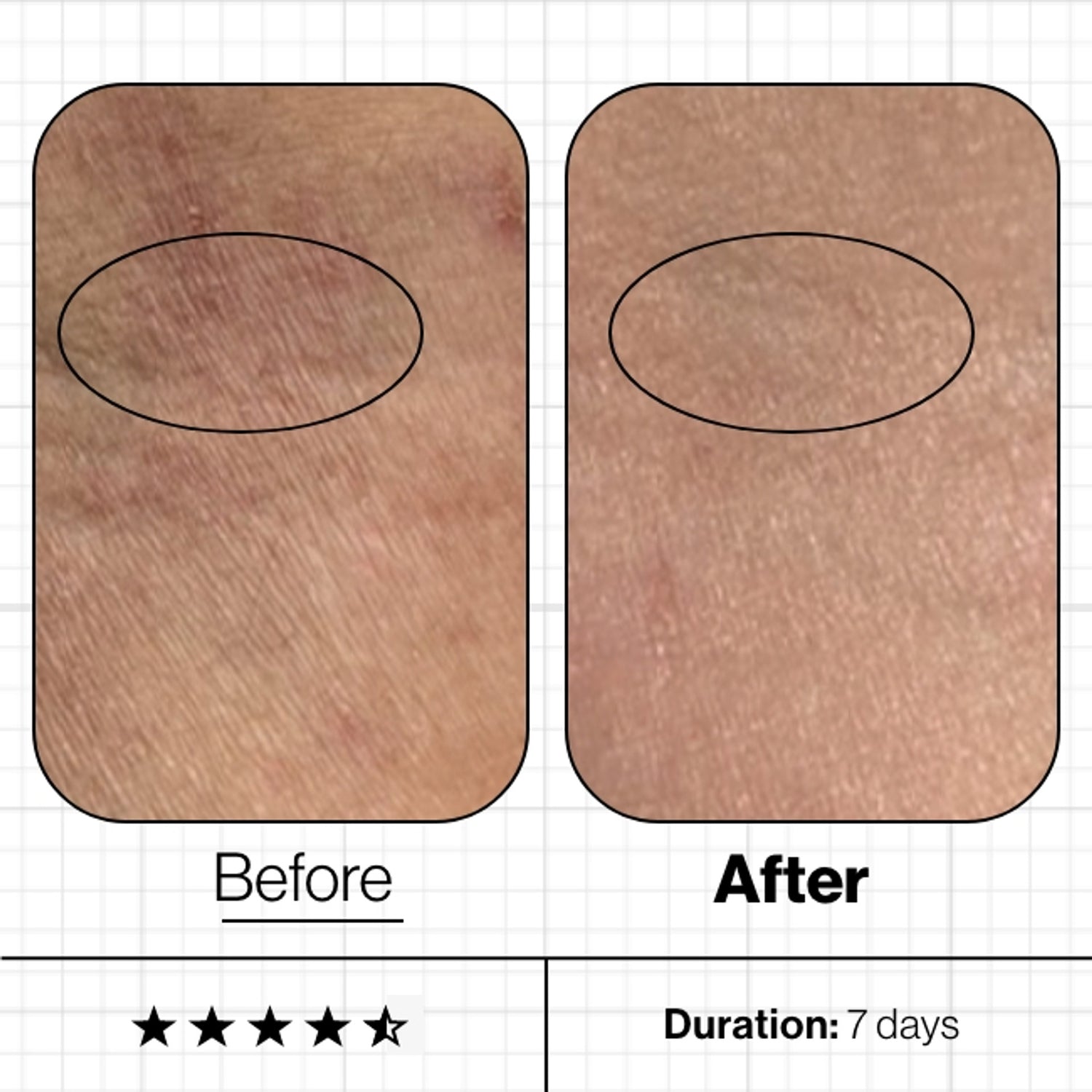 Advanced Nutrition Programme Skin Moisture IQ (NEW & IMPROVED)