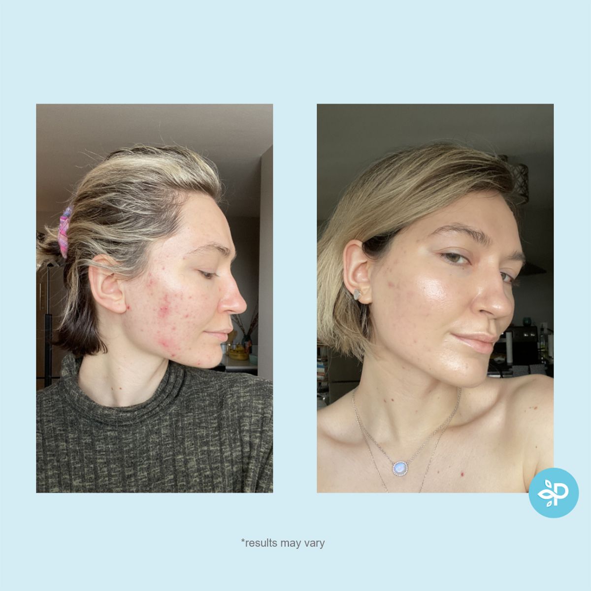 Hydro-Glo Peel Pads 10%