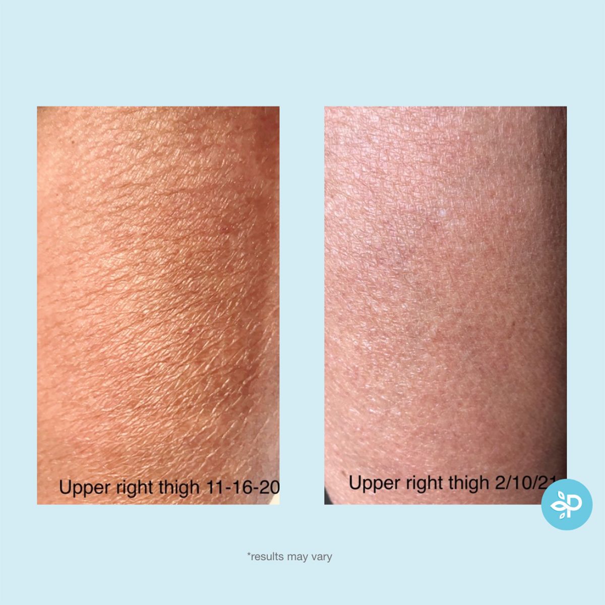 Gly + Sal Exfoliating Body Lotion