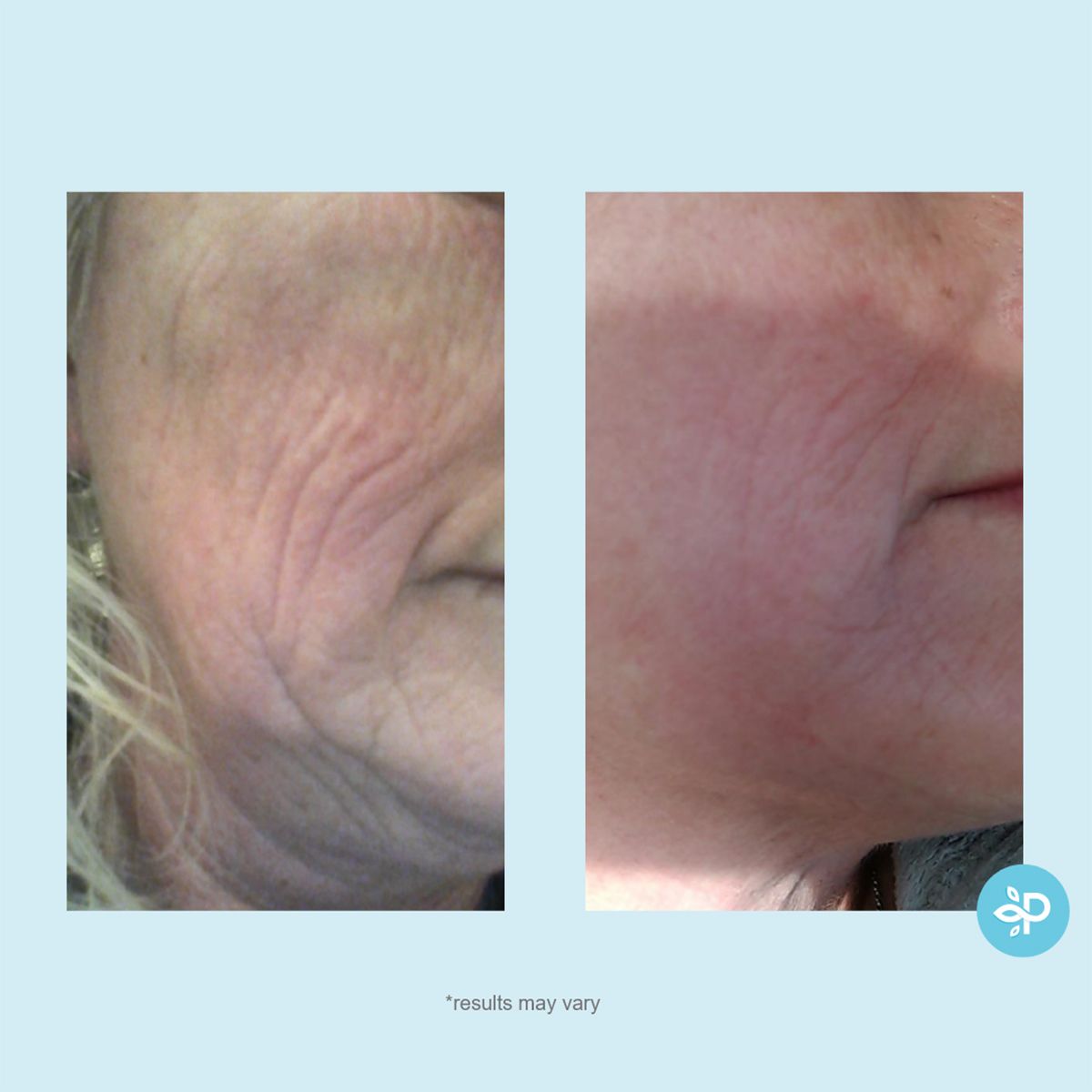 Hydra-Repair Wrinkle Cream