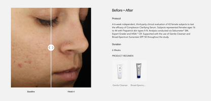 ZO Skin Health Complexion Clarifying Serum
