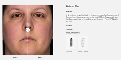 ZO Skin Health Recovery Crème