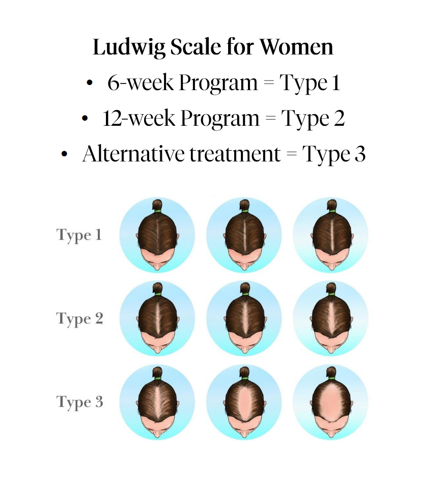 Calecim Advanced Hair System