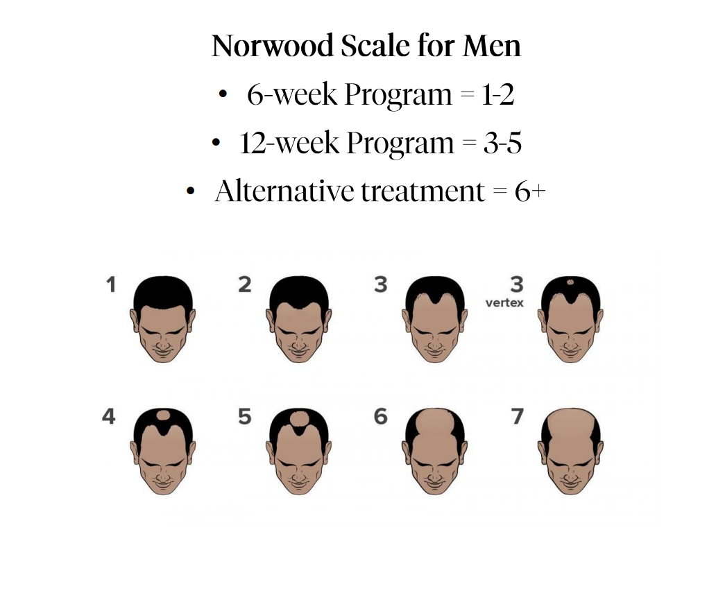 Calecim Advanced Hair System