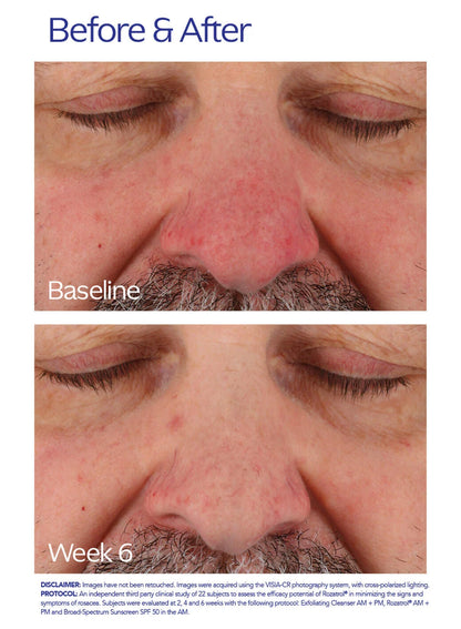 ZO Skin Health Rozatrol®