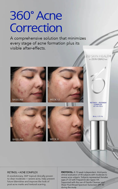 ZO Health Retinol + Blemish Complex