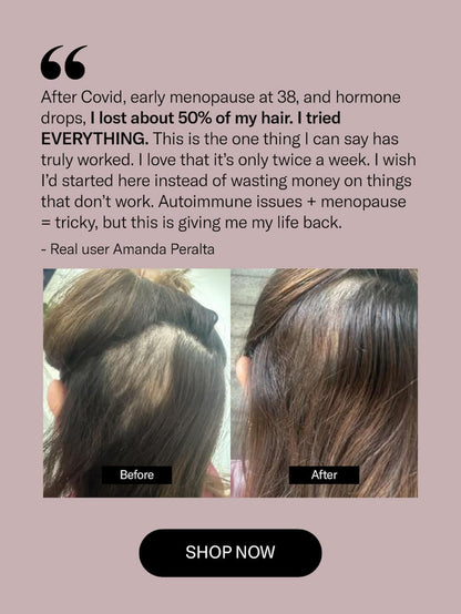 Calecim Advanced Hair System